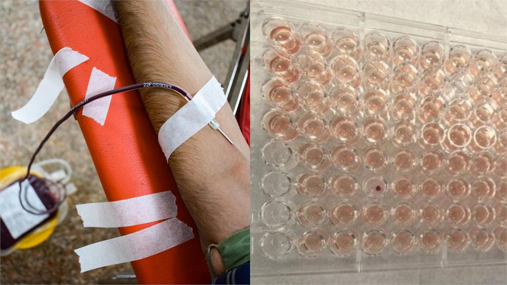 中國廣東血站驗出「罕見鑽石血」…出現機率竟比「熊貓血低百倍」超稀有!