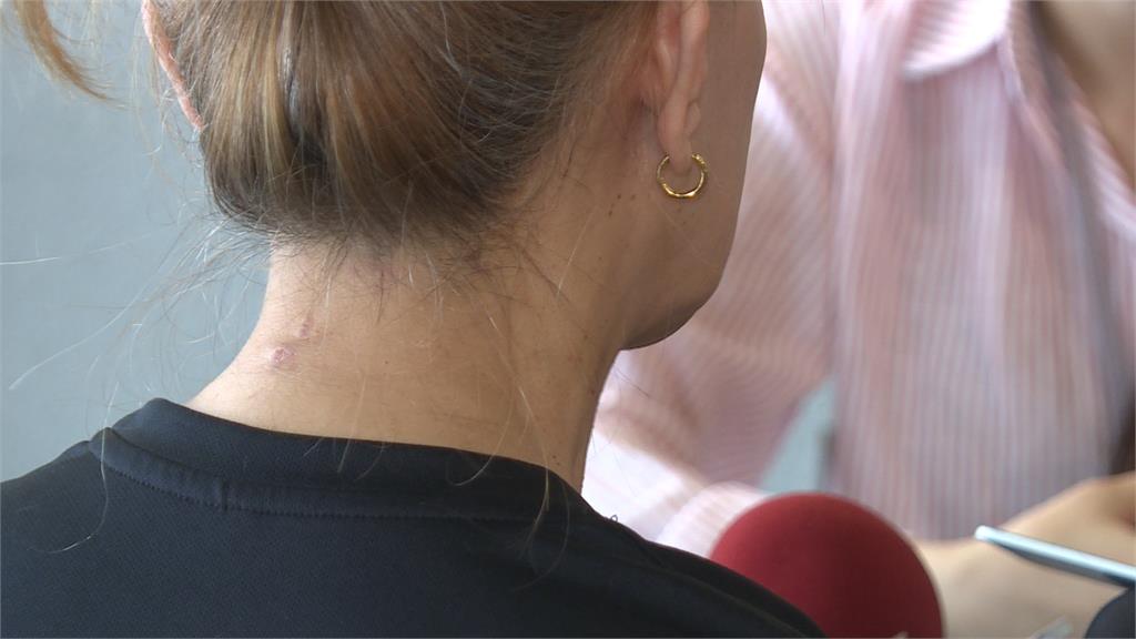 員工不滿店長情緒失控 拳腳相向 店長多處挫傷