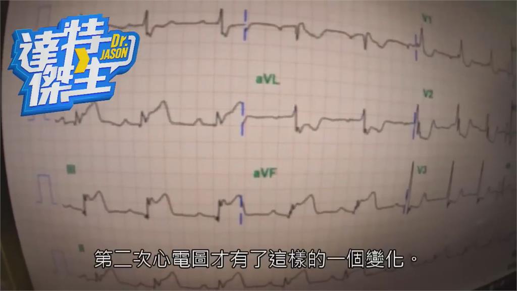 腸胃炎突變心肌梗塞!急診醫曝上班「鬼故事」 怕爆嘆:難怪沒人想幹