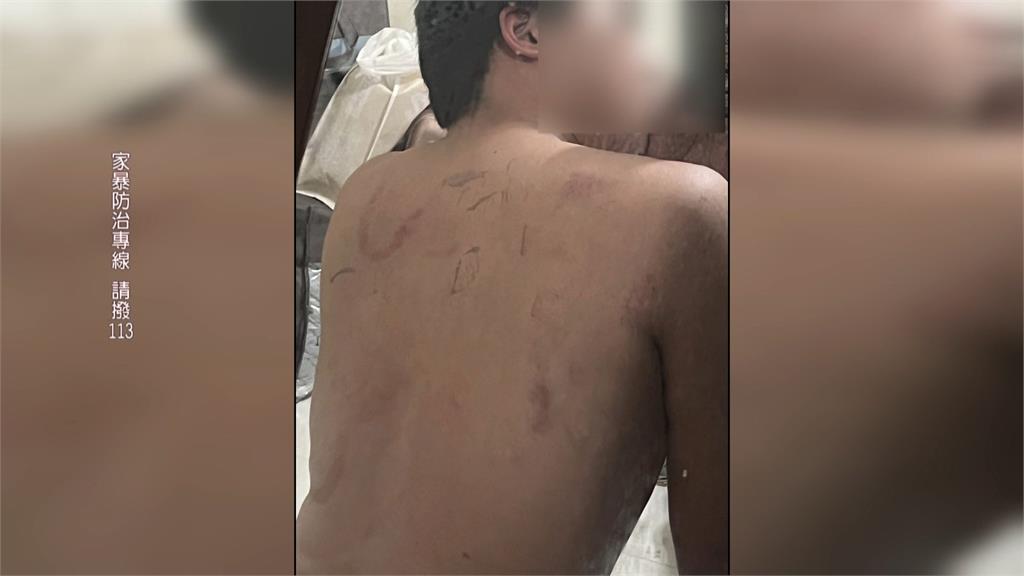 喝醉性情大變! 當街毆打20歲同性配偶長達近10分鐘