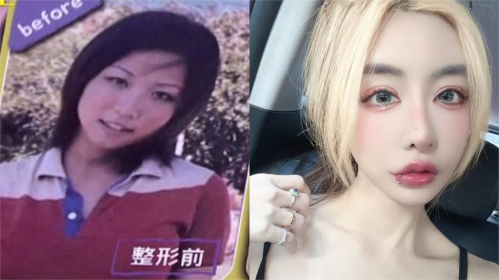 雪碧「女高時期」素顏舊照不藏了！昔砸800萬動刀「驚天落差」曝光