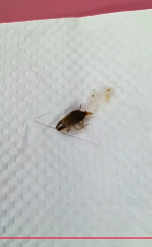 有影/柬埔寨男童喊耳痛 醫檢查驚見「活蟑螂瘋狂蠕動」駭人畫面流出