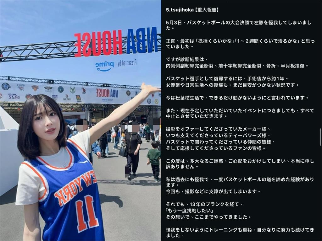 暗黑女優宣布回歸!昔雙韌帶「打到斷掉」傷勢慘重…停工數月復出時間曝光
