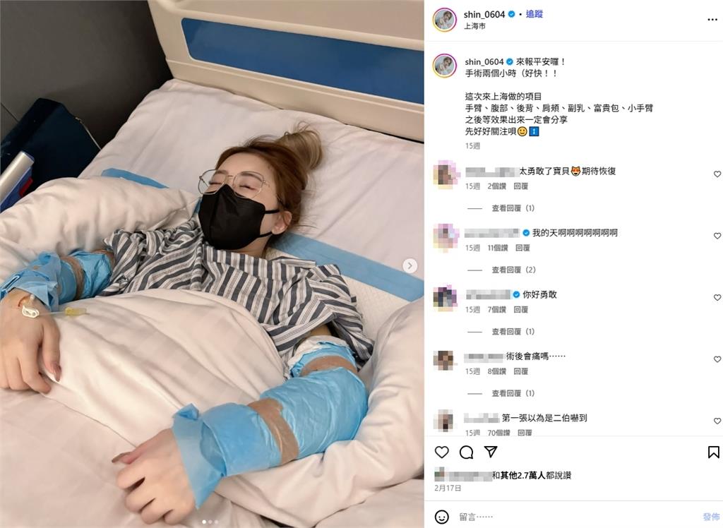 饅頭媽認了!全網羨慕「火辣身材」是整的 驚人舊照曝光:去中國抽脂