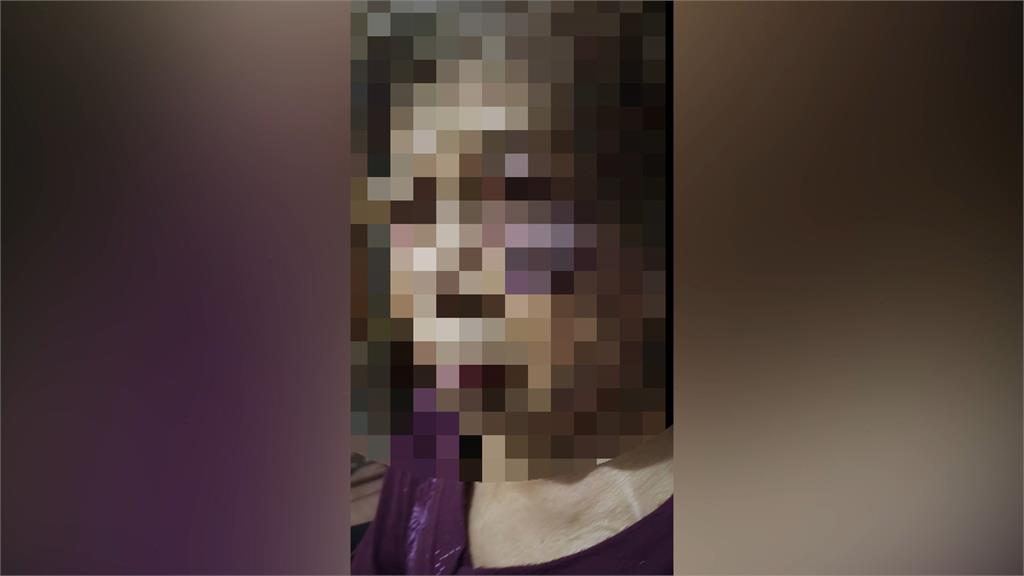 悚！印尼籍恐怖看護　虐待93歲阿嬤不停飆罵、扯髮、掌摑