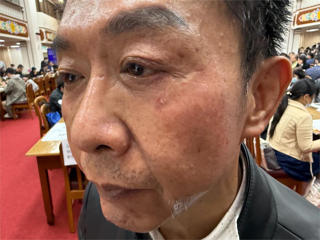 快新聞/傷勢曝光!選罷法肉搏戰 許智傑控遭邱鎮軍「壓頭4次」