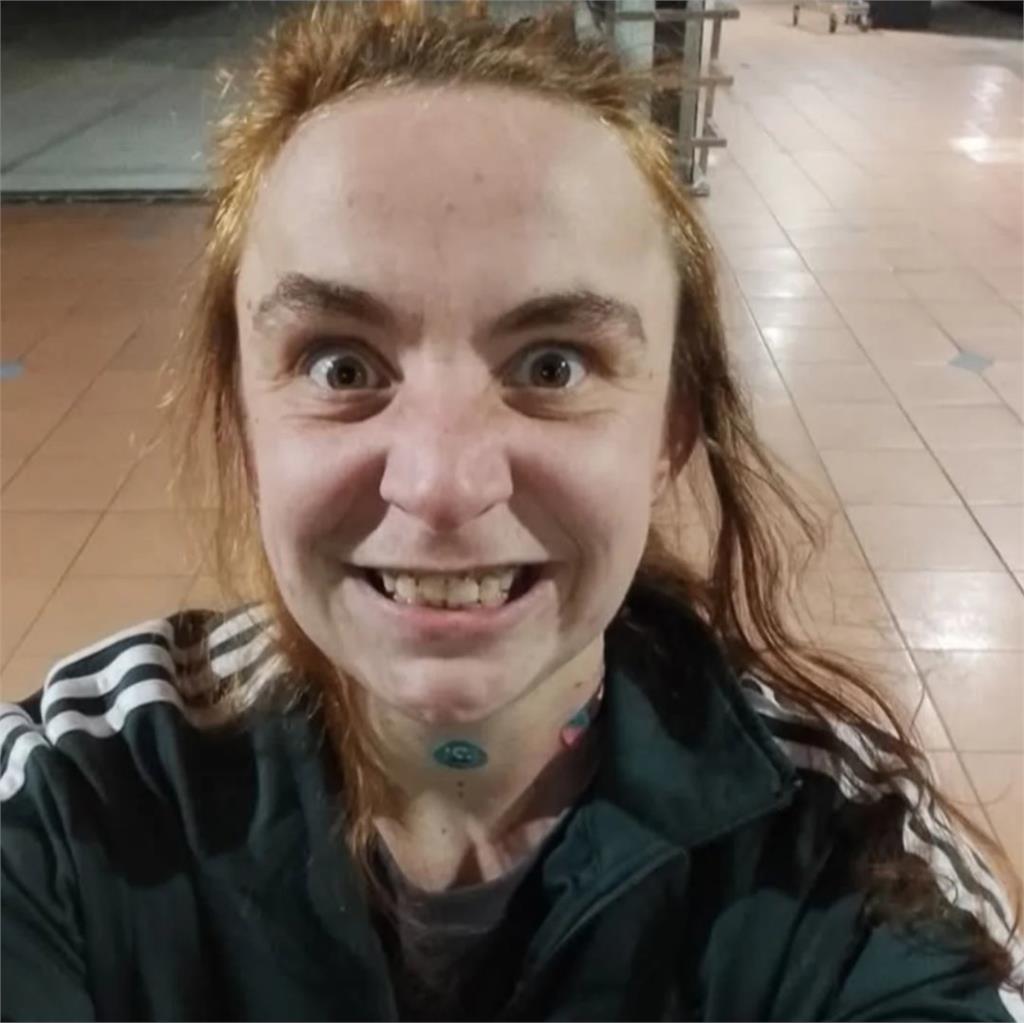 台籍女澳洲遇刺「肺穿孔重創」出院仍留後遺症!恐懼喊「看到路人都怕」政府出手了
