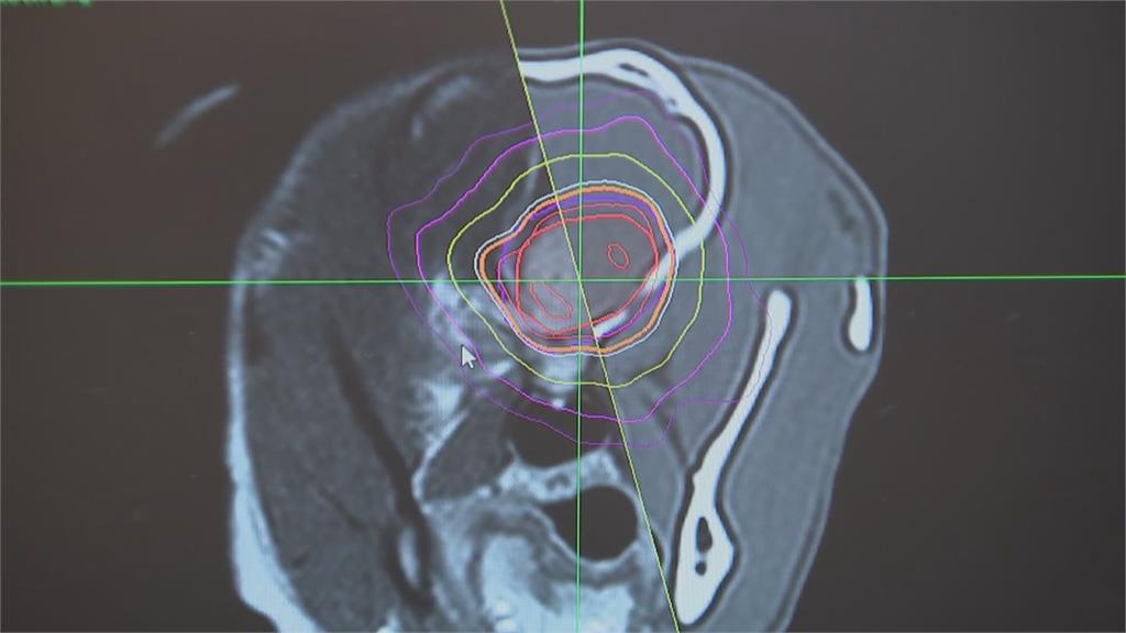 全球唯一！　美國賓州獸醫院　以電腦刀為毛小孩治療腫瘤