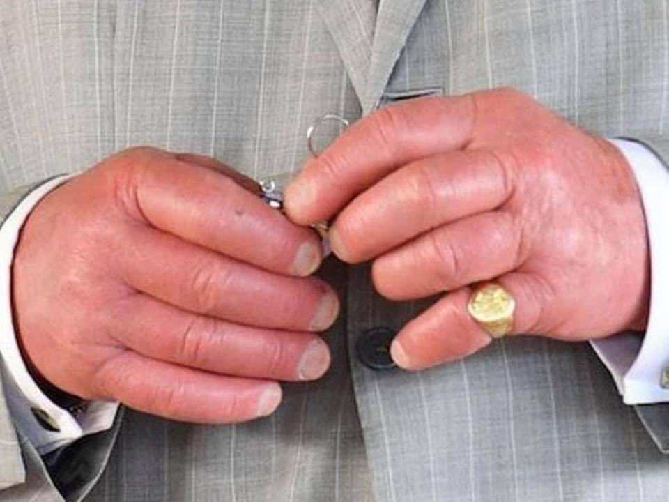 73歲英國國王剛上任健康亮紅燈？查爾斯「香腸手指照」推特瘋傳　