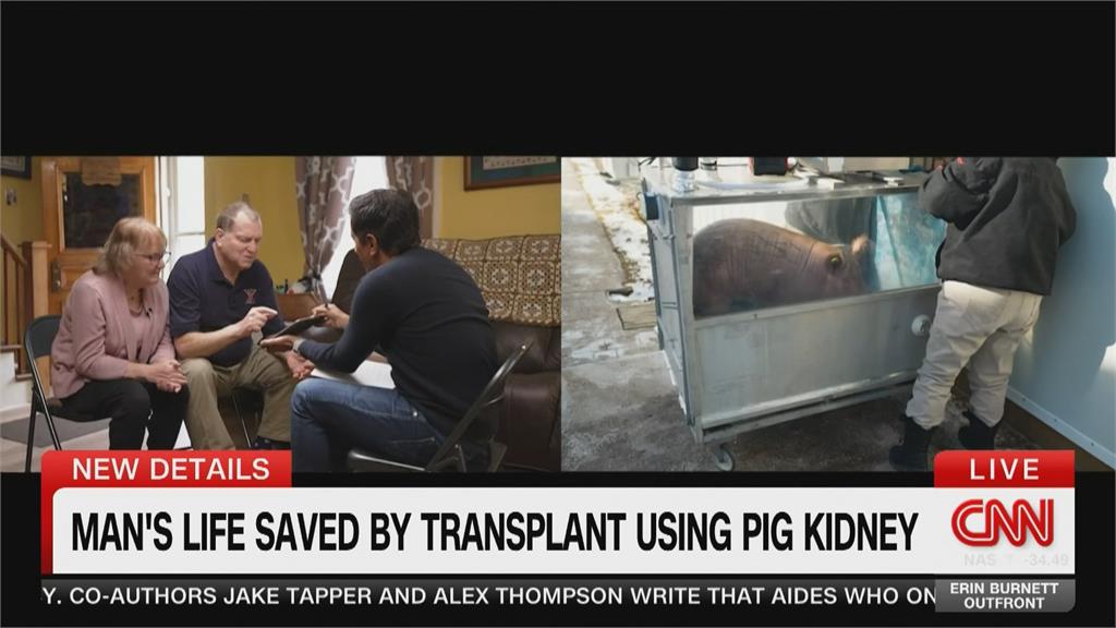美國男子移植豬腎成功 術後恢復良好成全球唯一存活案例