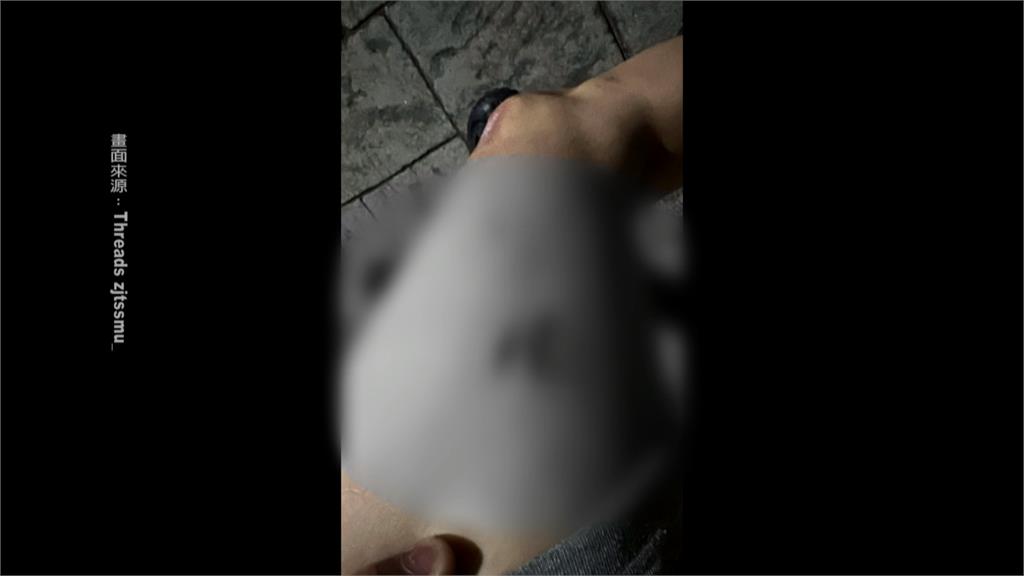 騎士遭快炒店黑狗咬傷 店家反嗆:怎麼咬人是牠的自由