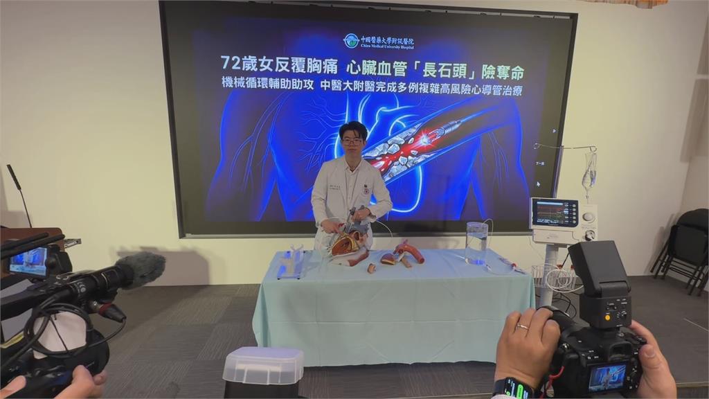 72歲女子心臟血管「長石頭」　胸痛、冒冷汗一週險奪命
