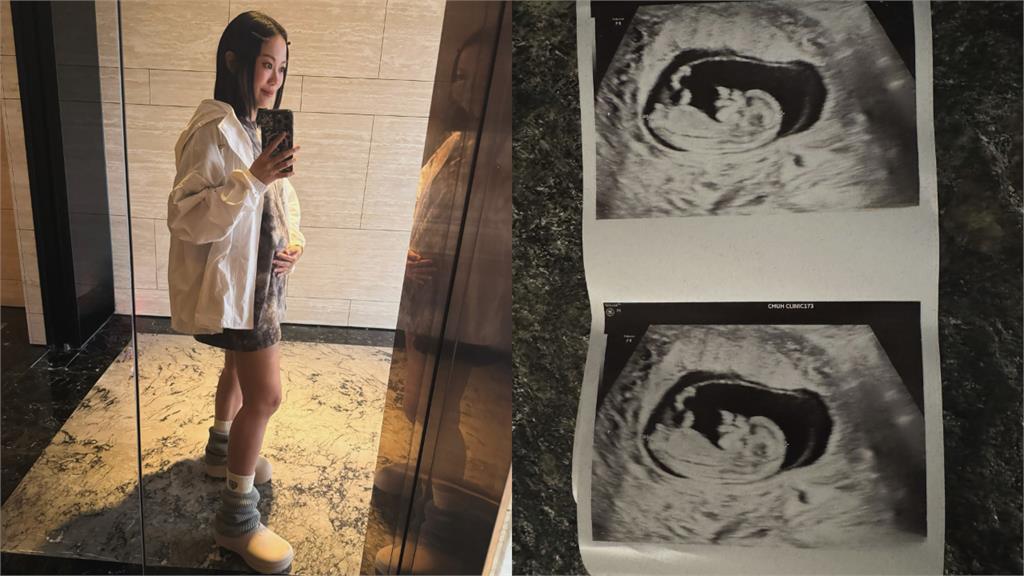 女兒未滿1歲老婆無預警報喜！高爾宣火速再當「二寶爸」嗨喊：來個孝子