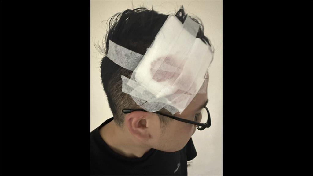 通緝犯駕車撞警遭擊斃 2警全身多處擦挫傷蔣萬安慰問
