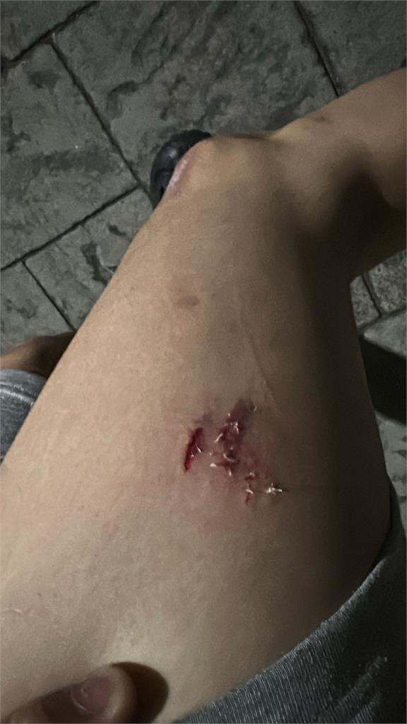 台中衰男騎車被狗咬!對飼主怒吼「走哪是我權利」遭嗆:牠怎麼咬你也是自由