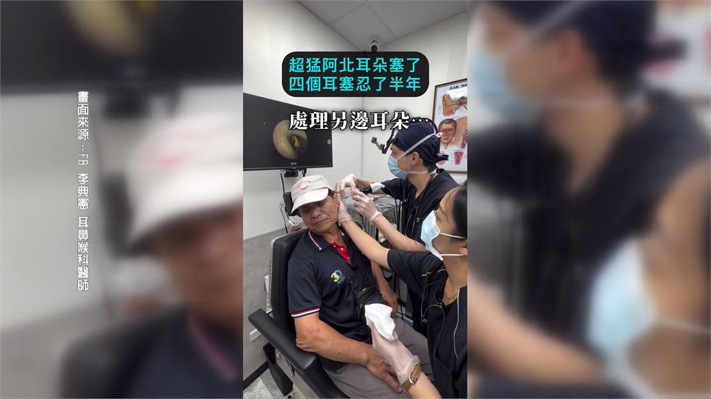 驚！雙耳卡4個耳塞殘骸　全部取出後60歲翁喊「都聽到了」