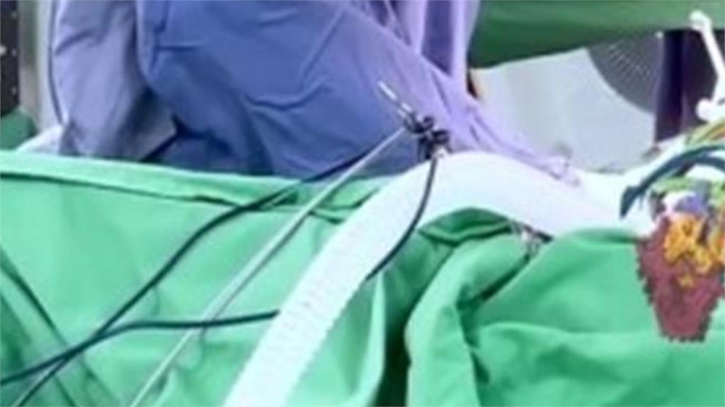 遭爆「無照醫療廠商執刀」醫生一旁納涼！中榮「態度大轉彎改口」發聲回應了