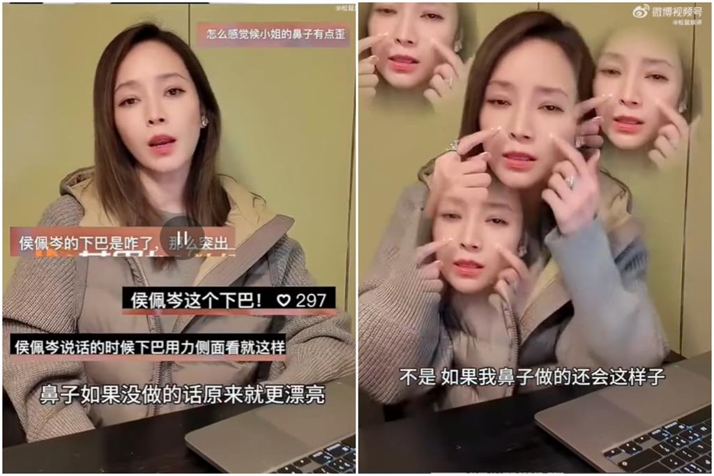 侯佩岑遭中國人質疑隆鼻墊下巴！她怒曝整形「首選1部位」：錢花在刀口上
