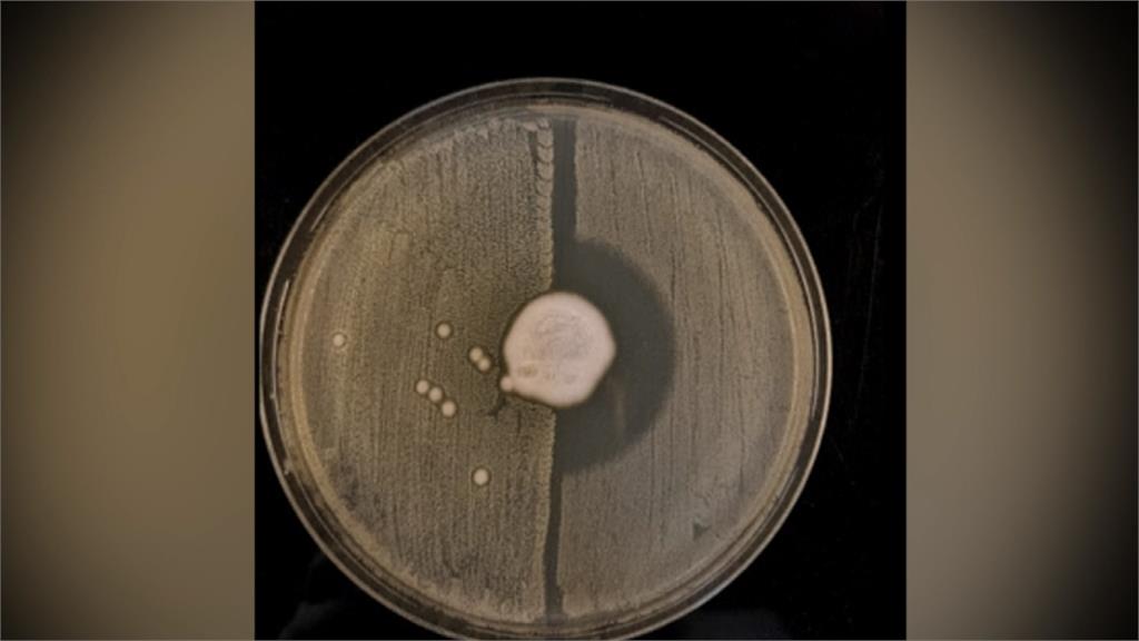 抗生素最怕！超級細菌解謎 「刺猬」身上自然演變