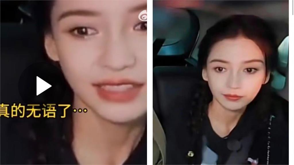 23歲歐陽娜娜狂抱怨「貓咪紋」惹baby變臉!直播喊冤曝糾結原因