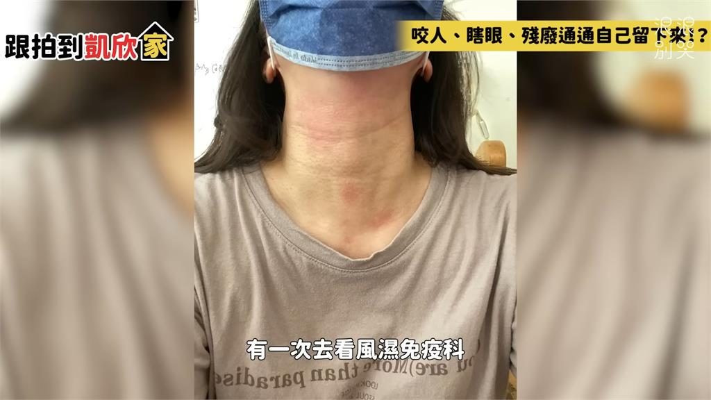 真心愛動物!醫生直言狗貓毛是過敏原 美女霸氣表示:要繼續養