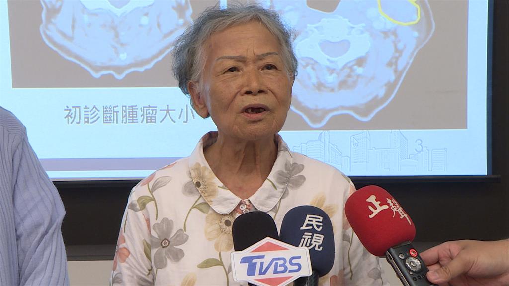 7旬嬤第四期下咽癌　「質子治療」　保住喉嚨