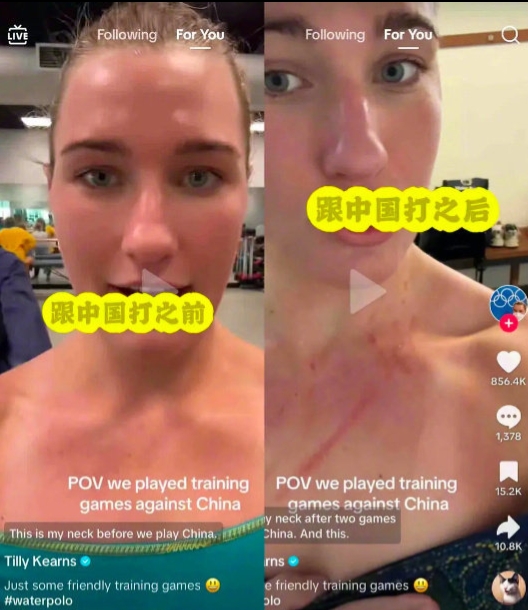 比水球變打架？中國、澳洲隊互秀「胸口抓痕」　隊長怒反擊：誰也別說誰