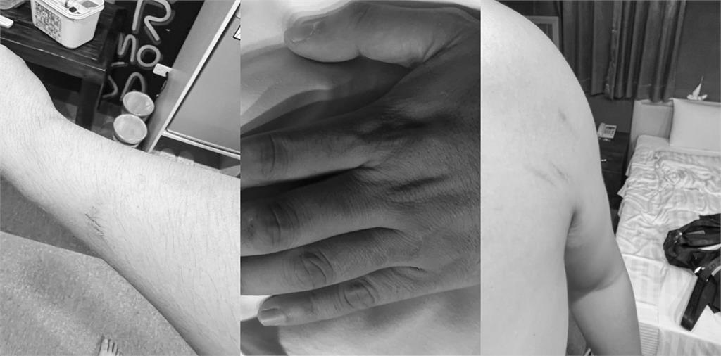 商旅「天花板整片崩塌」他躺床遭砸！妻氣炸曬「超扯畫面」業者急喊聲了