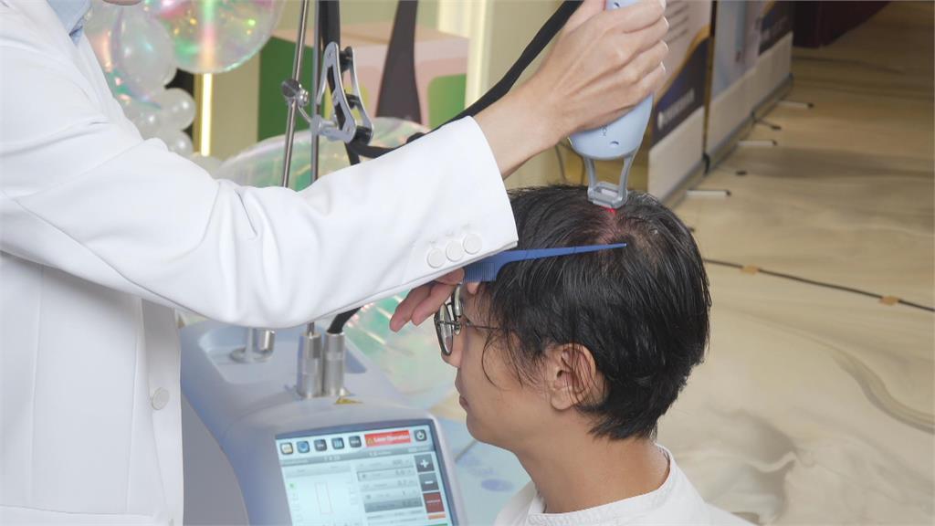 低能量雷射刺激頭皮　提升毛囊密度改善出油、乾屑問題