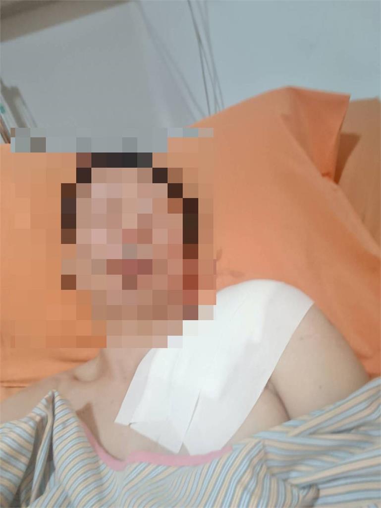 快新聞/安全氣囊變成砲彈!宜蘭男子發動車輛氣囊爆炸 右胸遭貫穿緊急送醫