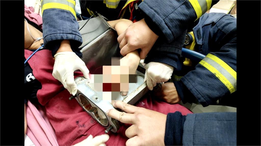 百年餅店驚傳意外! 女員工"手卡機器"3指骨頭碎裂