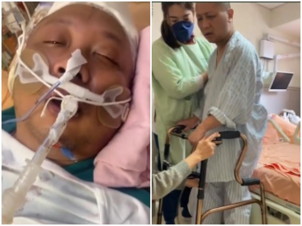 納豆復健畫面曝光!術後記憶「只剩模糊片段」自卑嘆:我是蠻弱的人