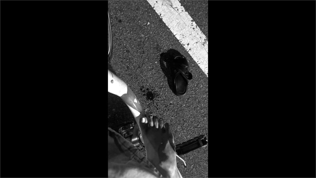 惡霸犬釀禍!新竹女騎腳踏車遇襲「腳趾甲掉落」爆血提告
