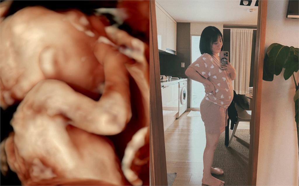 焦凡凡首公開超巨孕肚:好大了!被拍私下「1明顯變化」網驚:我懷孕也是