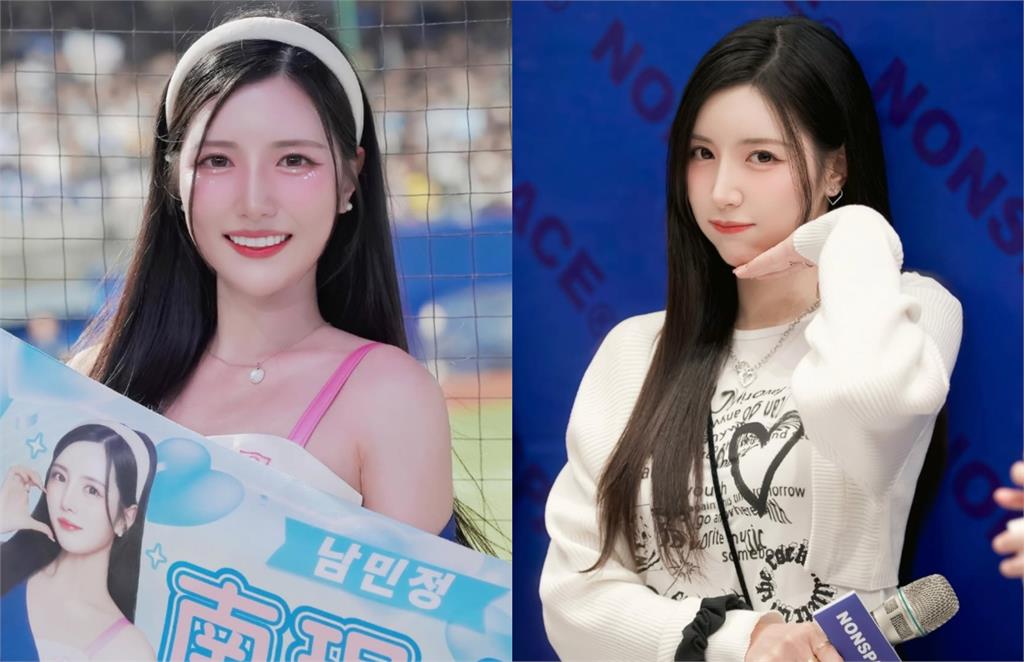 「台妹小南」突受傷!雪白嫩腿驚見「2大片瘀青」…65字心境全說了