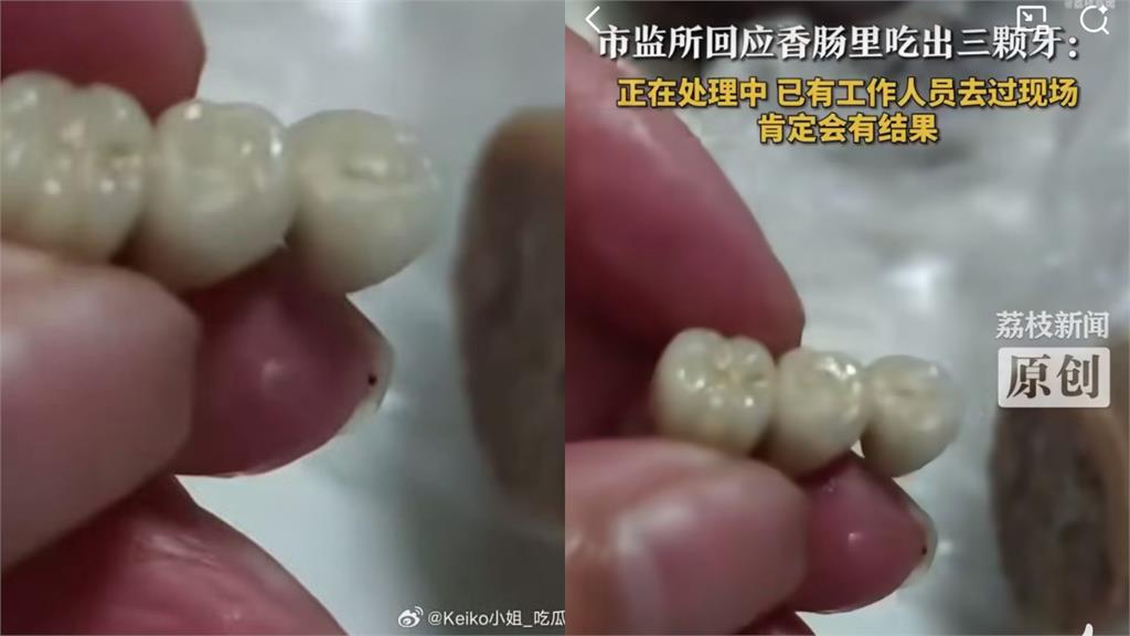 中國女吃香腸驚見「3顆牙齒」!燒賣再爆藏「連體人齒」網嚇瘋:該不會是活摘器官