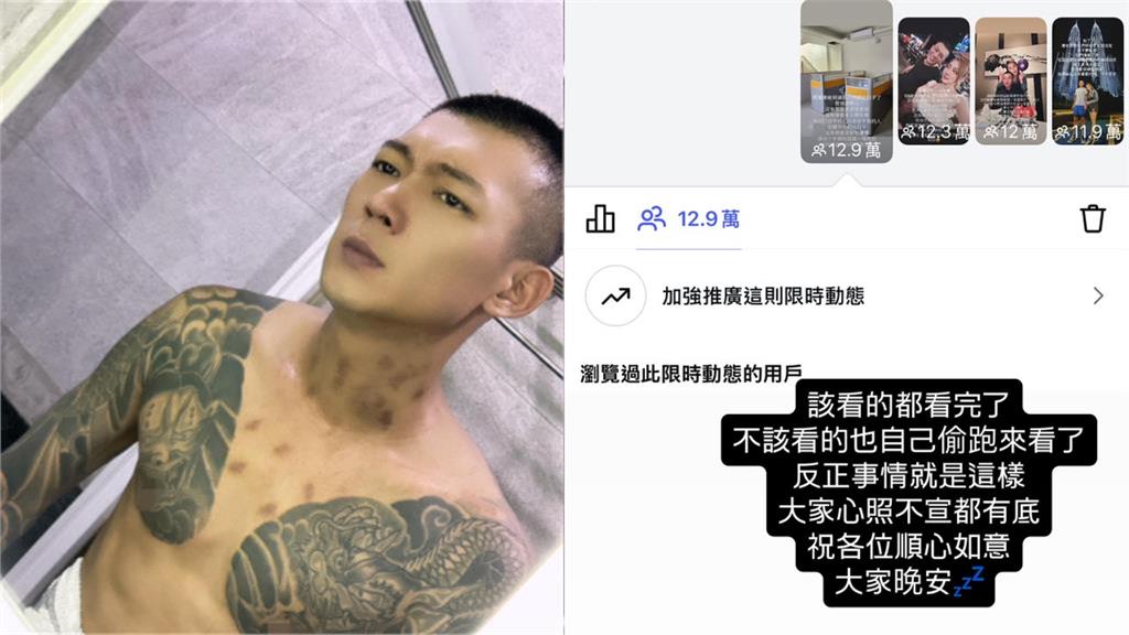 鳳梨遭開12槍又被潑泥突「刪光好友」！停更首談「抹黑內幕」認了：看透人性