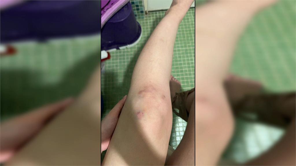 嘟嘟車出租營利遊走法律邊緣？　翻車受傷沒有保險還得賠車損