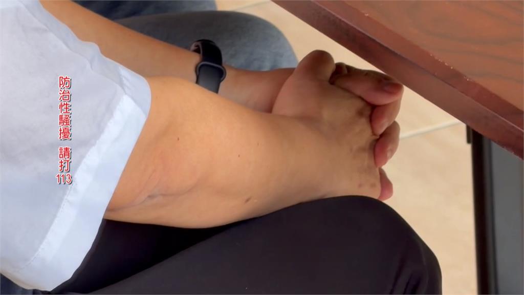 義消女運將控遭消防小隊長「強吻襲胸」　台中消防局：調離現職　　將依規處理