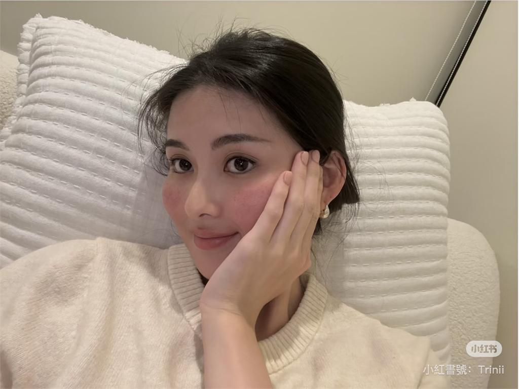 孫芸芸愛女卸妝後臉頰突「一片紅」　玫瑰斑發作她親吐「真實病情」