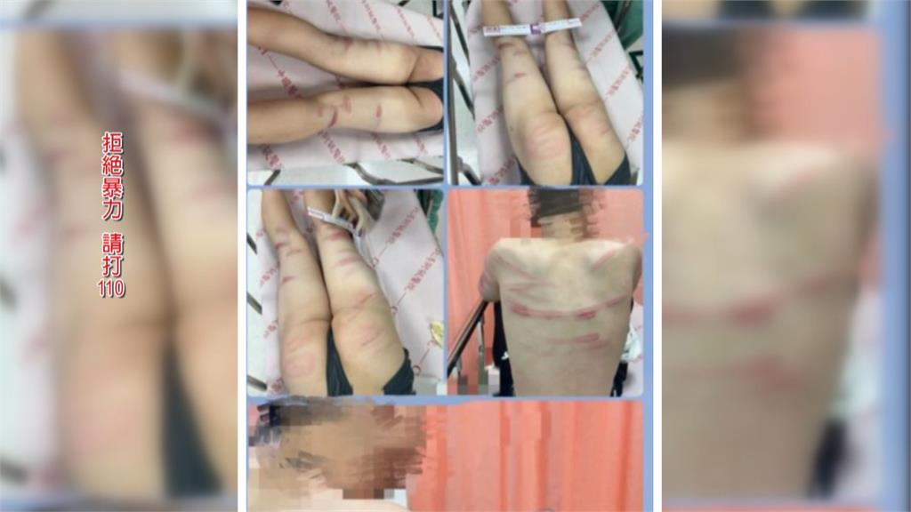 疑毒品糾紛黑吃黑! 3嫌擄被害人到鐵皮屋毆打
