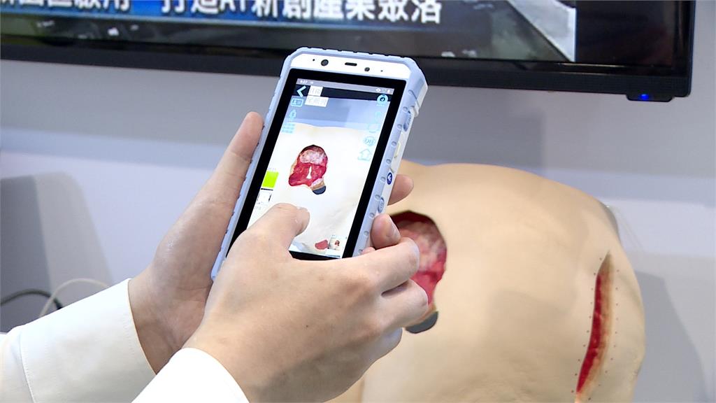 高齡健康產業博覽會 推出傷口照護機 智慧機能檢測鏡