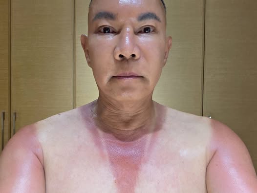 吊車大王首追「粉紅超跑」!徒步進香後貼裸身照「手變香腸色」喊:感動