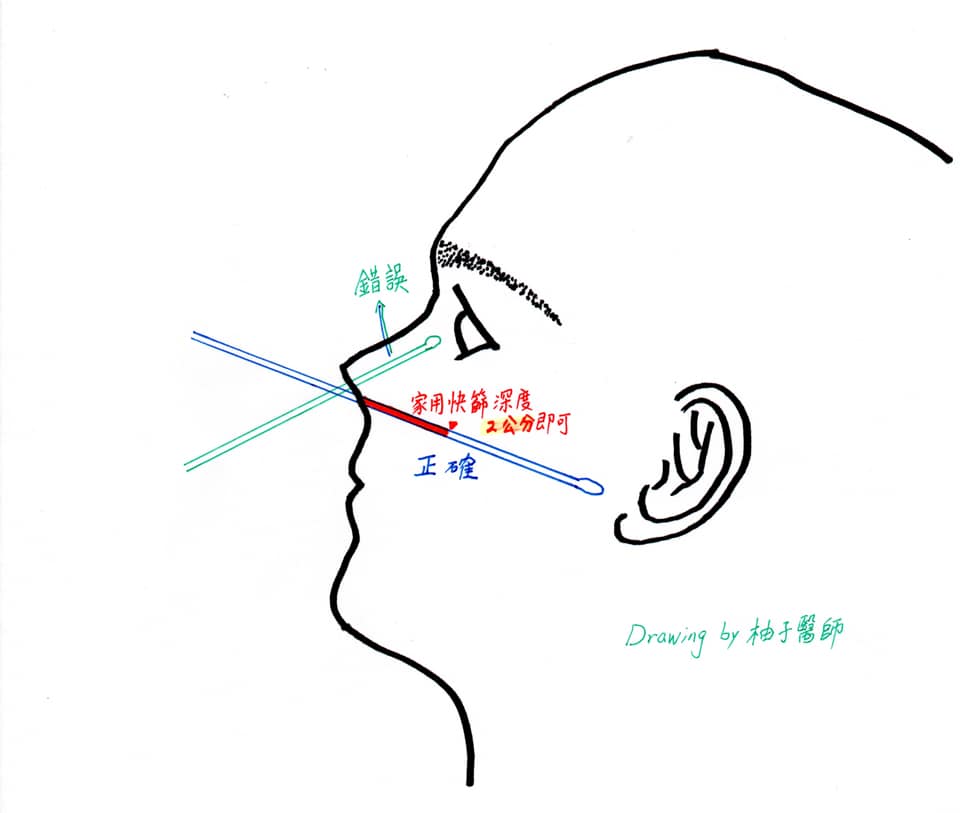 快新聞/一張圖看戳鼻子快篩角度!柚子醫師提醒:戳錯方向「就進入腦袋」
