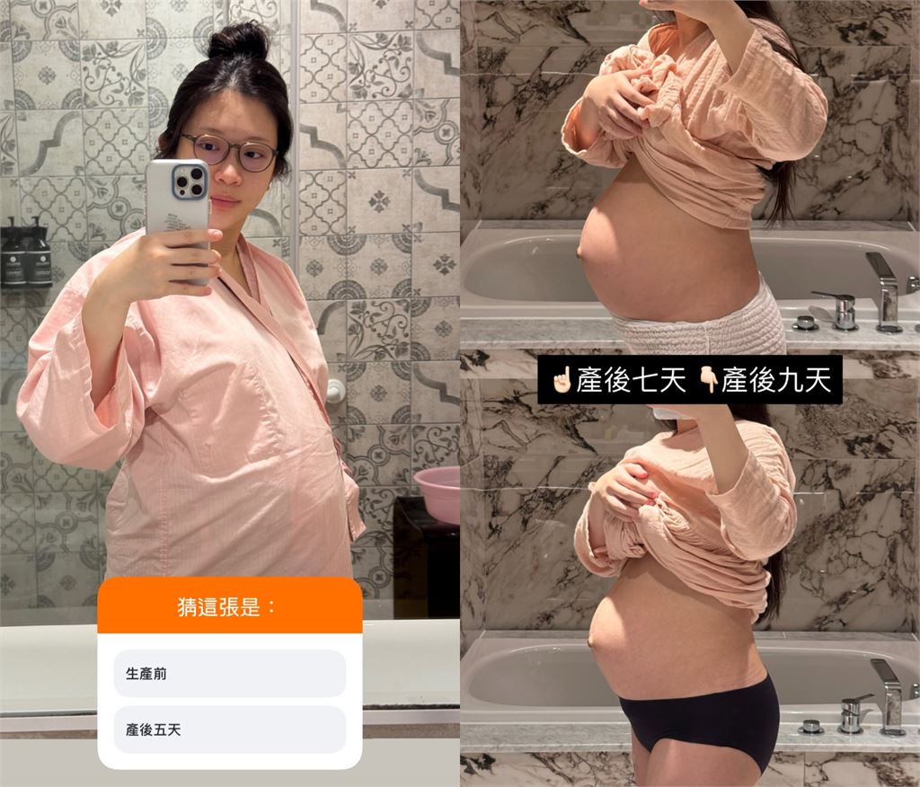 鄭家純生完雙胞胎才9天！「真實肚圍38吋」近照曝光…驚人變化全說了