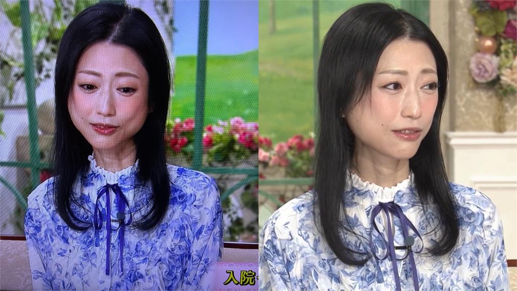 情色女王「雙頰凹陷」整尊認不出!壇蜜自爆「2度住院」…真實病因曝光