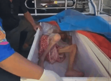 65歲婦人「死而復生」狂敲棺材！親弟激動流淚：差一點就送去火化