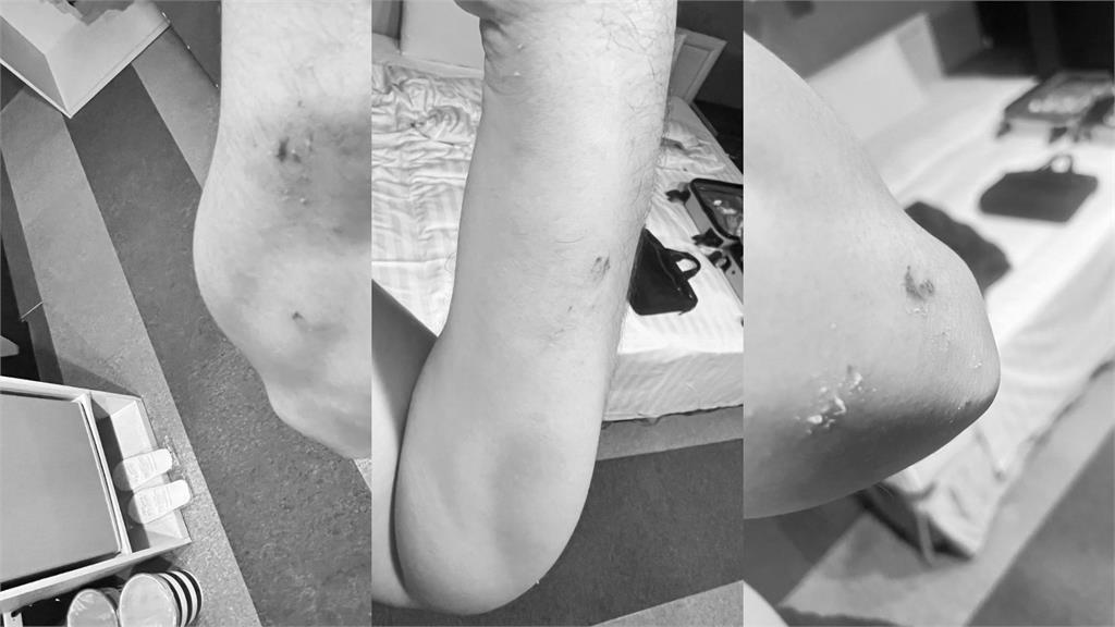 商旅「天花板整片崩塌」他躺床遭砸！妻氣炸曬「超扯畫面」業者急喊聲了