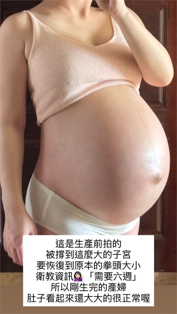 鄭家純生完雙胞胎才9天！「真實肚圍38吋」近照曝光…驚人變化全說了