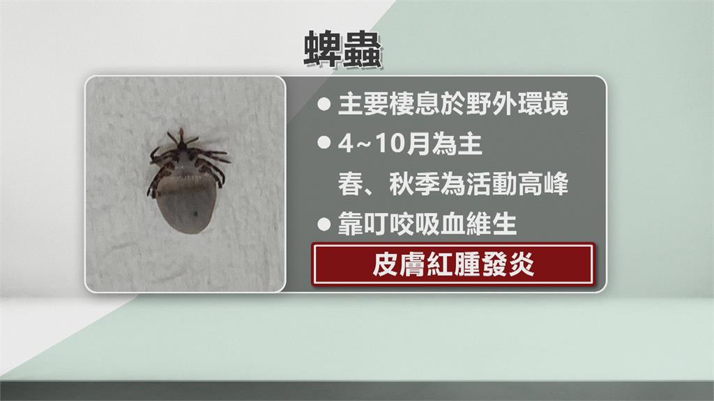 婦人遊日返台肩膀痛10幾天 就醫驚見皮膚內埋「這個」